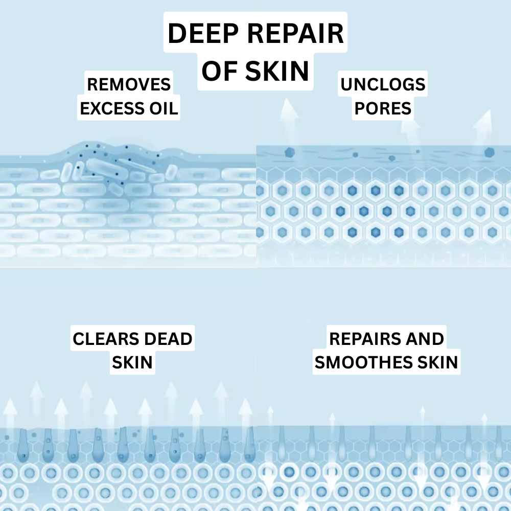 From flare-ups to flawless, visibly clearer skin with every use of Acne Gel