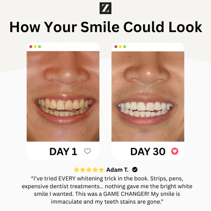 Whiter Teeth, Healthier Gums — Every Brush, Every Day.