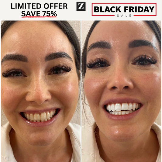 Whiter Teeth, Healthier Gums — Every Brush, Every Day.