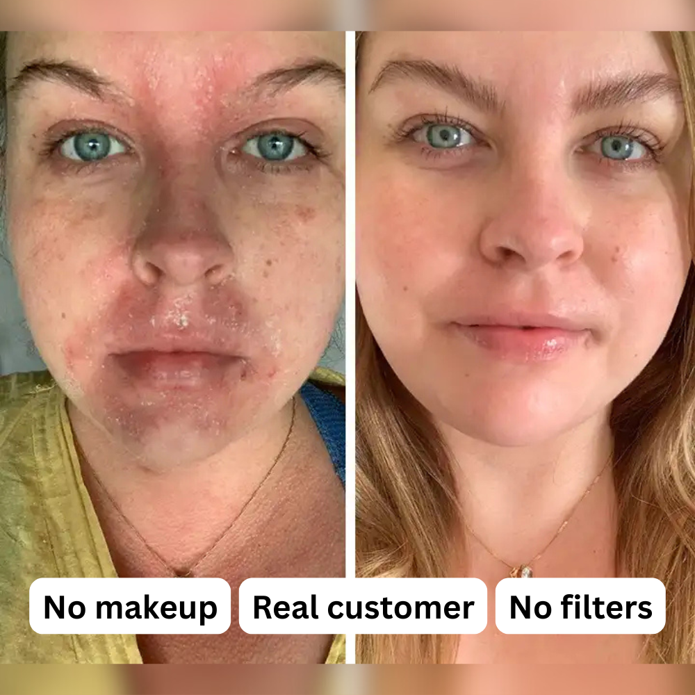 From flare-ups to calm skin, moisturizing, healing, protecting Tallow & Honey Balm