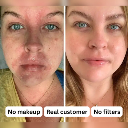 From flare-ups to calm skin, moisturizing, healing, protecting Tallow & Honey Balm