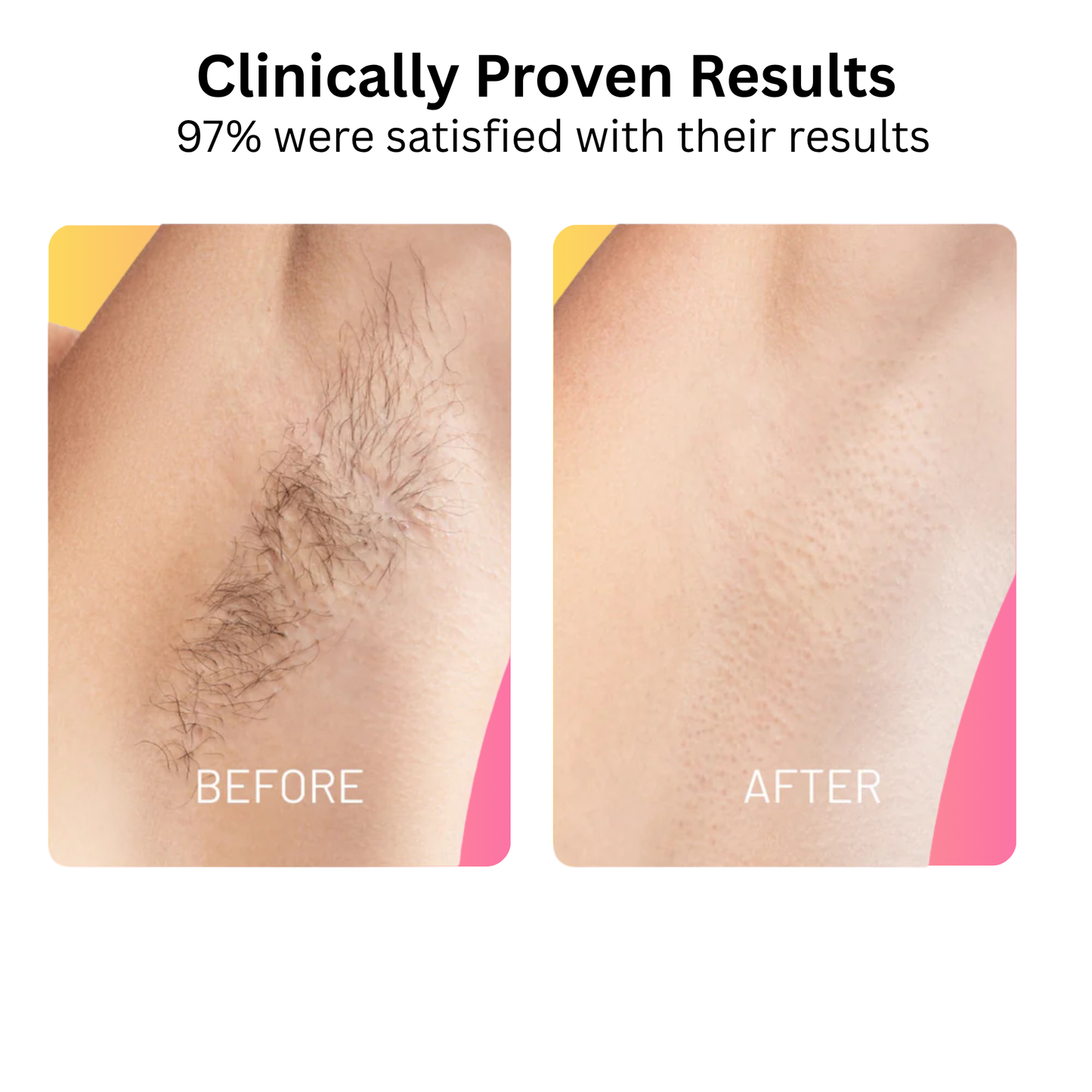 SilkRoot™ Hair Removing Oil