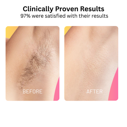 SilkRoot™ Hair Removing Oil